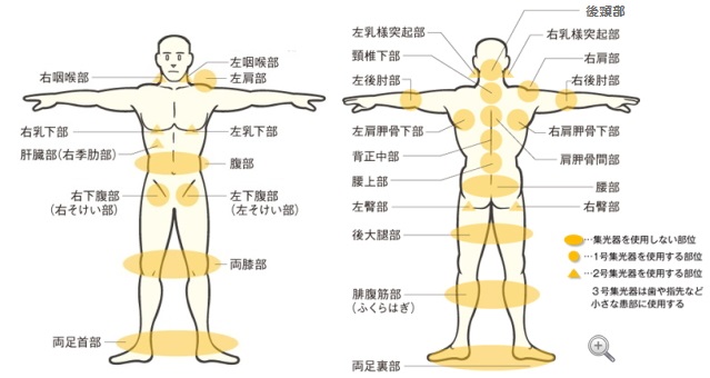 照射の部位例